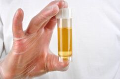 Urine testing is one method of diagnosing prostatitis
